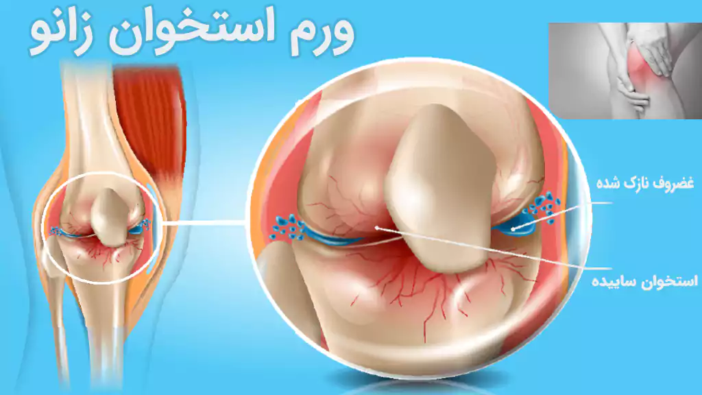 فیزیوتراپی چیست و انواع دستگاههای فیزیوتراپی